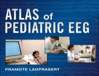 Cover image: Atlas of Pediatric EEG 1st edition 9780071623346
