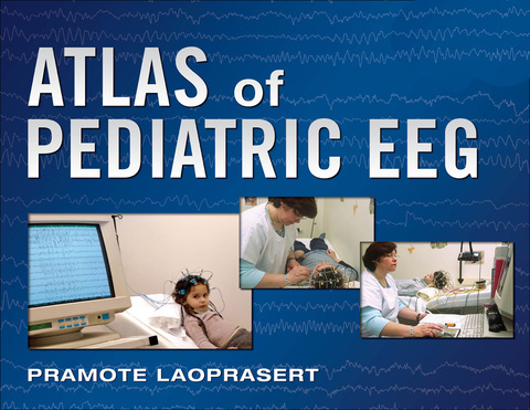 Atlas of Pediatric EEG, 1st Edition - FULL INSTANT DOWNLOAD | PDF DOCX EPUB
