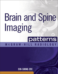 صورة الغلاف: Brain and Spine Imaging Patterns 1st edition 9780071465410