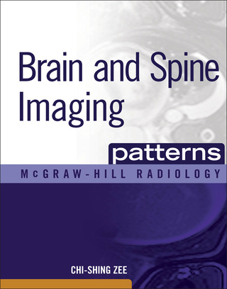 Titelbild: Brain and Spine Imaging Patterns 1st edition 9780071465410