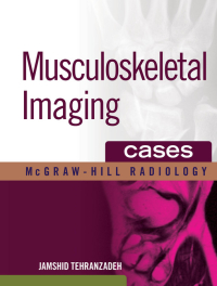Cover image: Musculoskeletal Imaging Cases 1st edition 9780071465427