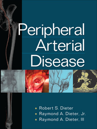 Cover image: Peripheral Arterial Disease 1st edition 9780071481793