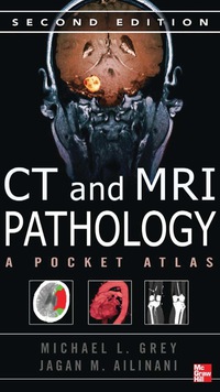 Omslagafbeelding: CT & MRI Pathology: A Pocket Atlas, Second Edition 2nd edition 9780071703192