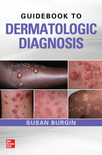 صورة الغلاف: Guidebook to Dermatologic Diagnosis 1st edition 9780071738750