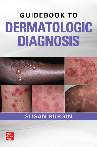 表紙画像: Guidebook to Dermatologic Diagnosis 1st edition 9780071738750