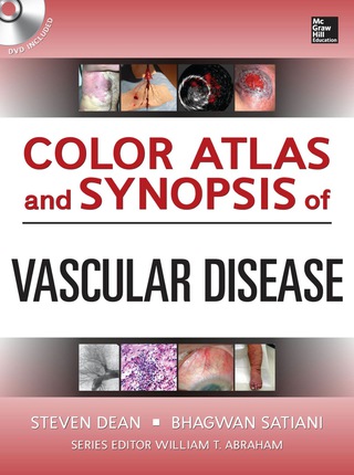 Cover image: Color Atlas and Synopsis of Vascular Disease 1st edition 9780071749541
