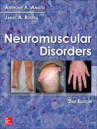 صورة الغلاف: Neuromuscular Disorders, 2nd Edition 2nd edition 9780071752503