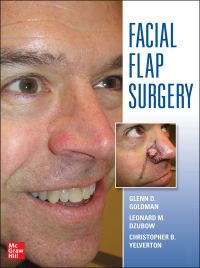表紙画像: Facial Flaps Surgery 1st edition 9780071749251