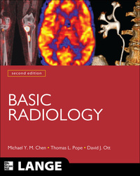 Cover image: Basic Radiology, Second Edition 2nd edition 9780071627085