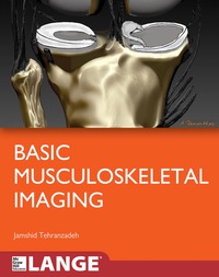 表紙画像: Basic Musculoskeletal Imaging 1st edition 9780071787024