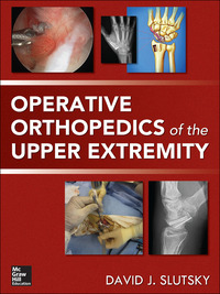 Cover image: Operative Orthopedics of the Upper Extremity 1st edition 9780071789271
