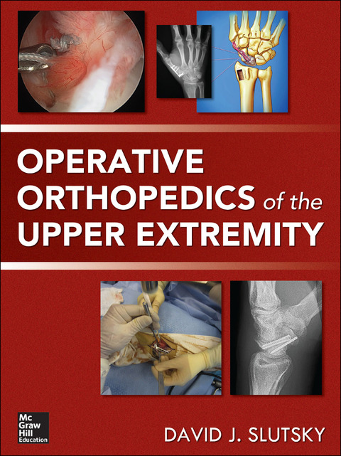 Operative Orthopedics of the Upper Extremity, 1st Edition - FULL INSTANT DOWNLOAD | PDF DOCX EPUB