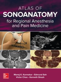 Omslagafbeelding: Atlas of Sonoanatomy for Regional Anesthesia and Pain Medicine 1st edition 9780071789349