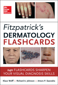 表紙画像: Fitzpatricks Dermatology Flash Cards 1st edition 9780071794169