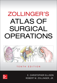 صورة الغلاف: Zollinger's Atlas of Surgical Operations 10th edition 9780071797559