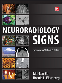 Cover image: Neuroradiology Signs 1st edition 9780071804325