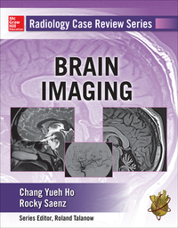 Cover image: Radiology Case Review Series: Brain Imaging 1st edition 9780071826914