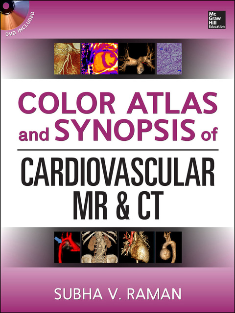 Color Atlas and Synopsis of Cardiovascular MR and CT (SET 2), 1st Edition - FULL INSTANT DOWNLOAD | PDF DOCX EPUB