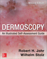 表紙画像: Dermoscopy: An Illustrated Self-Assessment Guide 2nd edition 9780071834346