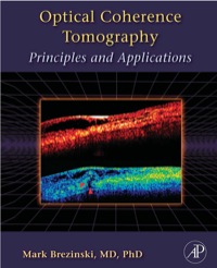 Immagine di copertina: Optical Coherence Tomography 9780121335700