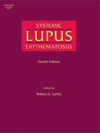 Cover image: Systemic Lupus Erythematosus 4th edition 9780124339019