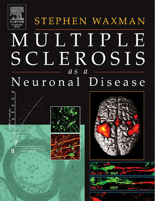 صورة الغلاف: Multiple Sclerosis As A Neuronal Disease 9780127387611