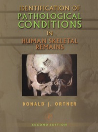 صورة الغلاف: Identification of Pathological Conditions in Human Skeletal Remains 2nd edition 9780125286282