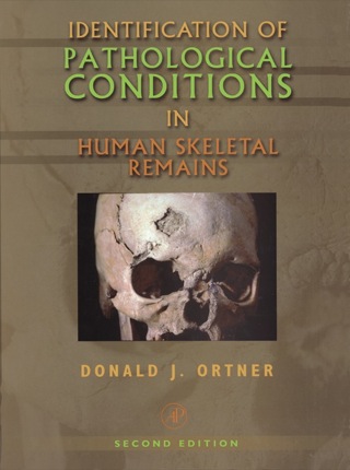 Cover image: Identification of Pathological Conditions in Human Skeletal Remains 2nd edition 9780125286282