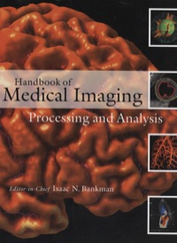Imagen de portada: Handbook of Medical Imaging 9780120777907