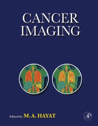 Cover image: Cancer Imaging 9780123704689