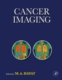 Cover image: Cancer Imaging 9780123741837