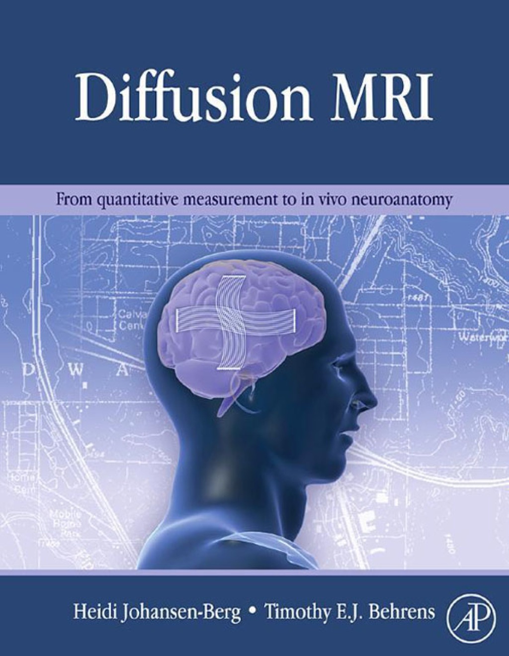 Diffusion MRI (eBook)