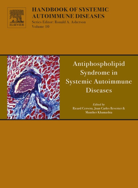 Antiphospholipid Syndrome in Systemic Autoimmune Diseases - FULL INSTANT DOWNLOAD | PDF DOCX EPUB