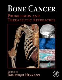 Titelbild: Bone Cancer 9780123748959