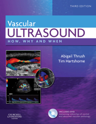 Imagen de portada: Vascular Ultrasound 3rd edition 9780443069185