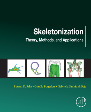 صورة الغلاف: Skeletonization 9780081012918