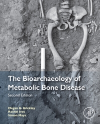 表紙画像: The Bioarchaeology of Metabolic Bone Disease 2nd edition 9780081010204