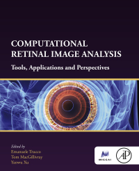 表紙画像: Computational Retinal Image Analysis 9780081028162