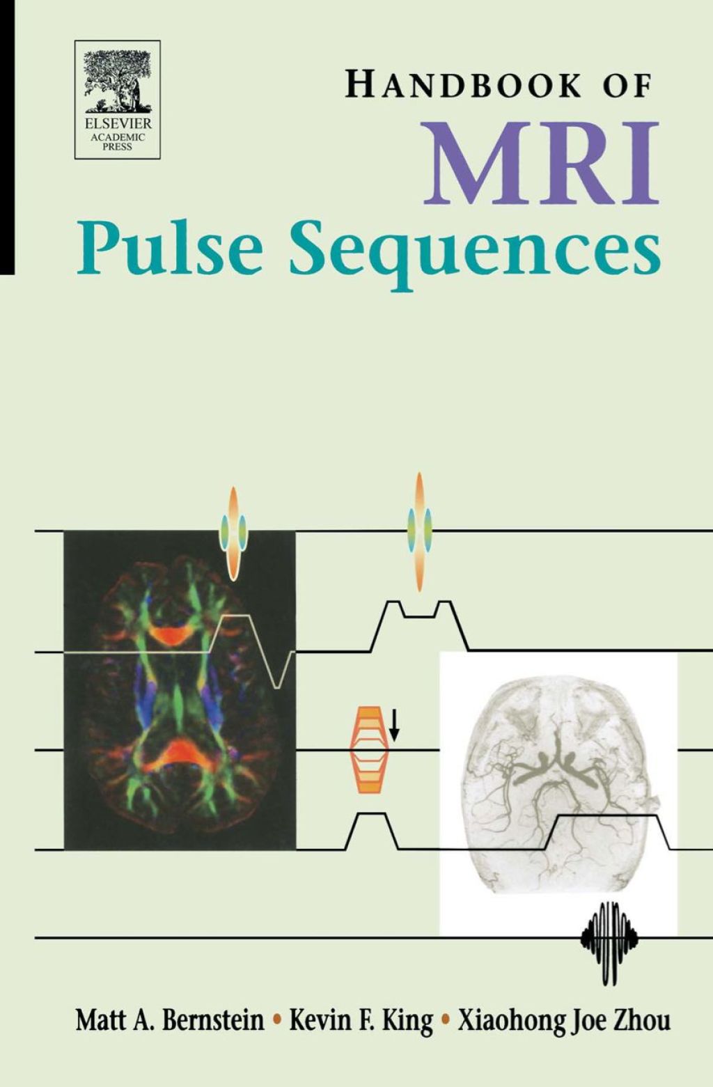 Handbook of MRI Pulse Sequences (eBook Rental) - Bernstein;  Matt A.; King;  Kevin F.; Zhou;  Xiaohong Joe,