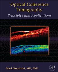 Cover image: Optical Coherence Tomography: Principles and Applications 9780121335700
