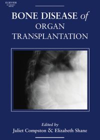 Cover image: Bone Disease of Organ Transplantation 9780121835026