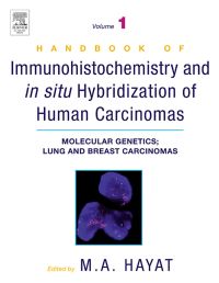 Immagine di copertina: Handbook of Immunohistochemistry and in Situ Hybridization of Human Carcinomas: Molecular Genetics; Lung and Breast Carcinomas 9780123339416