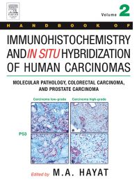 Cover image: Handbook of Immunohistochemistry and in Situ Hybridization of Human Carcinomas: Molecular Pathology, Colorectal Carcinoma, and Prostate Carcinoma 9780123339423