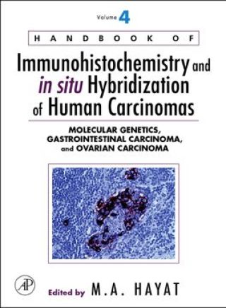 Cover image: Handbook of Immunohistochemistry and in situ Hybridization of Human Carcinomas: Molecular Genetics, Gastrointestinal Carcinoma, and Ovarian Carcinoma 9780123694027
