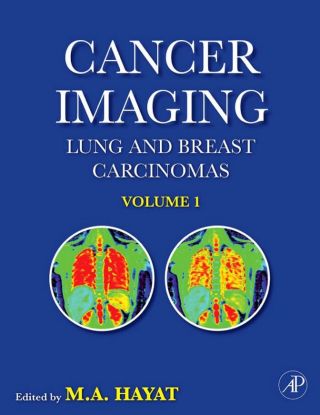Cover image: Cancer Imaging: Lung and Breast Carcinomas 9780123704689