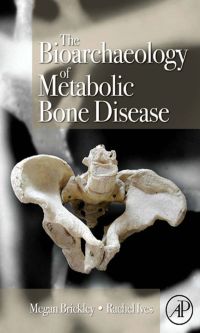 Titelbild: The Bioarchaeology of Metabolic Bone Disease 9780123704863