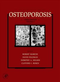 Cover image: Osteoporosis 3rd edition 9780123705440