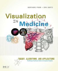 Cover image: Visualization in Medicine: Theory, Algorithms, and Applications 9780123705969