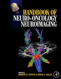 Titelbild: Handbook of Neuro-Oncology Neuroimaging 9780123708632