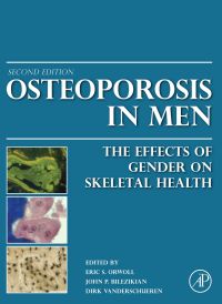 Omslagafbeelding: Osteoporosis in Men: The Effects of Gender on Skeletal Health 2nd edition 9780123746023